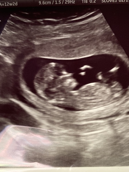 Due September 2022 (Thread 4)