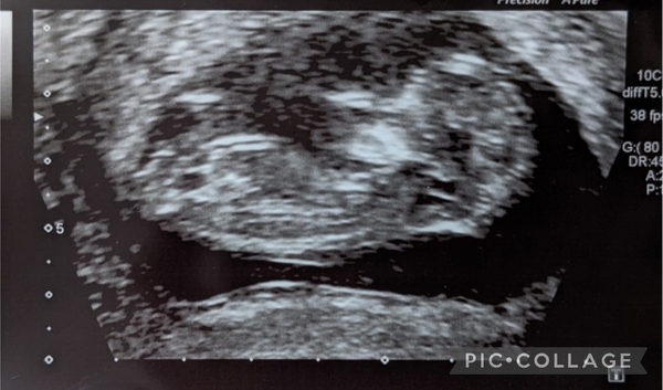 Due September 2022 (Thread 4)