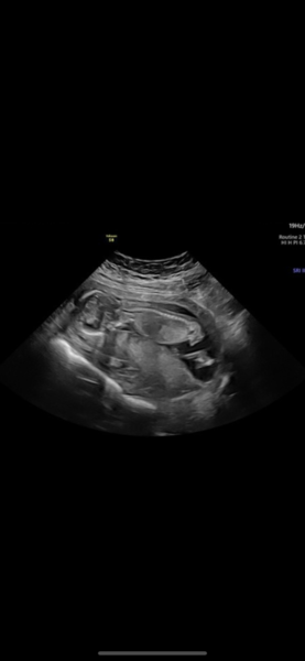 Boy or girl?