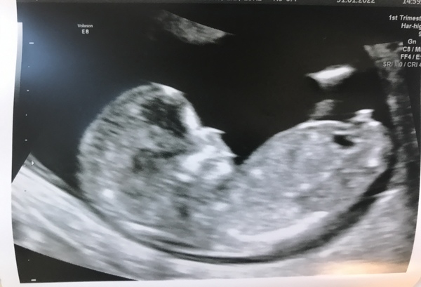 Could you help me guess the sex?