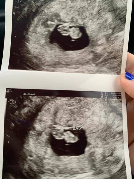 Due September 2022 - Thread #3