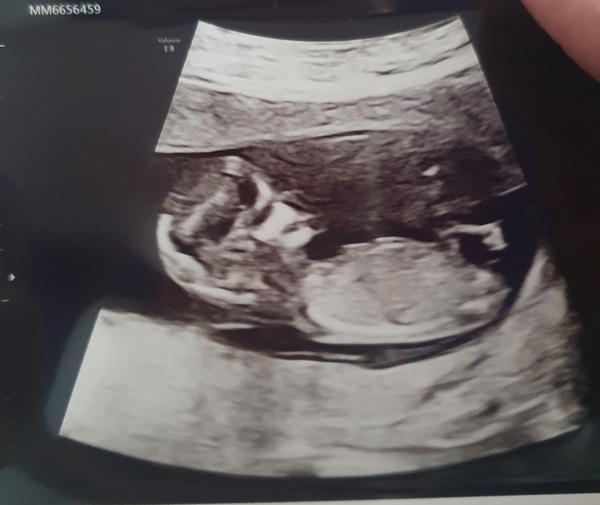Any sex guesses just for fun