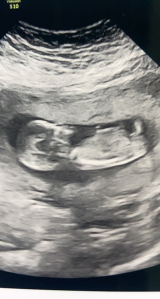 Due August 2022