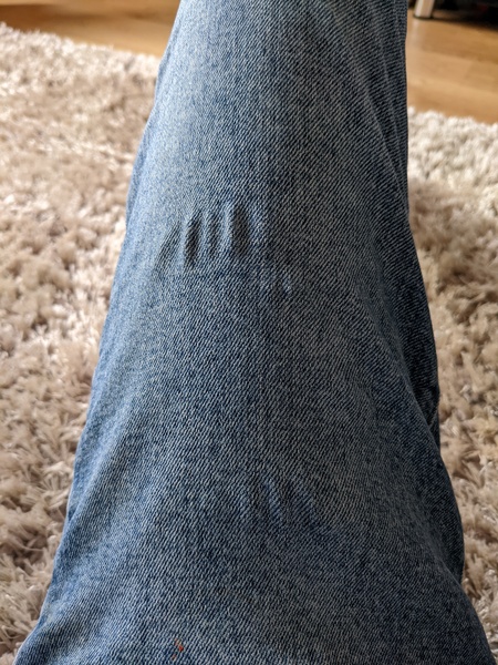 Why are my Levi's doing this