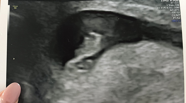 Due October 2022