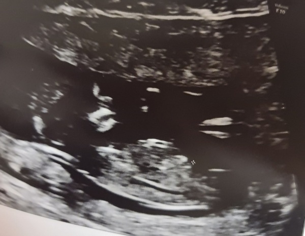 Due September 2022 (Thread 4)