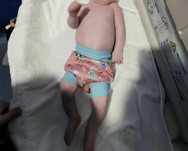 Can’t stop worrying about Cerbral Palsy
