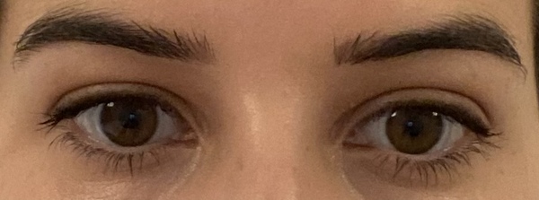 What would you do with these eyes?