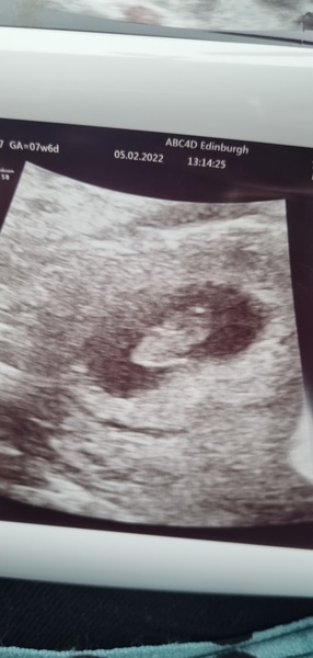 Due September 2022 - Thread #3