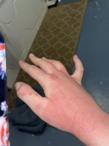 To go to A&E?