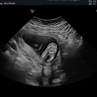 Boy or Girl?? Guesses?