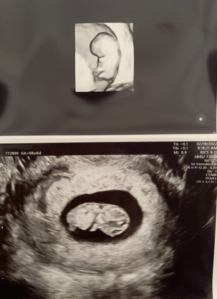 Due September 2022 (Thread 4)