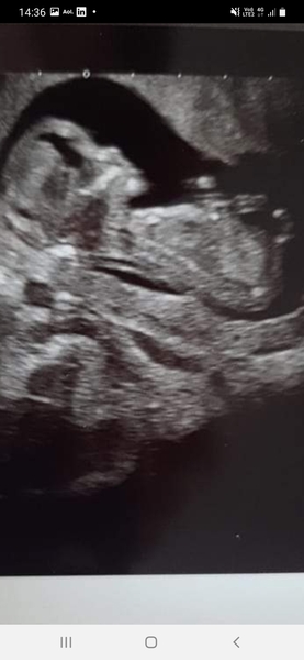 Boy or Girl (just for fun)
