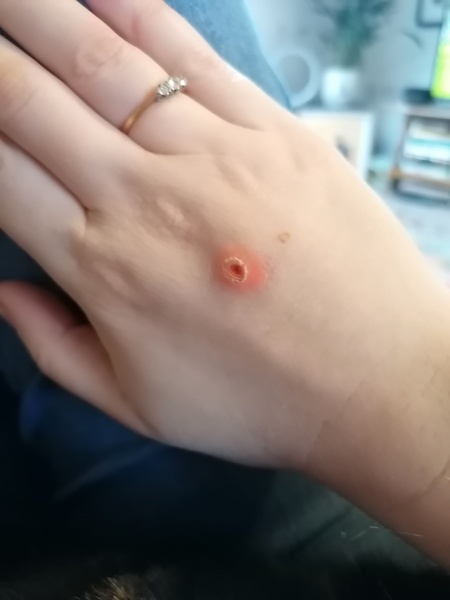 Is this cellulitis?