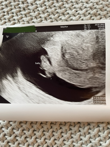 Pregnancy buddies