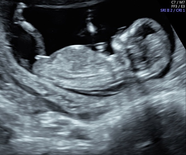Can anyone guess the sex?!