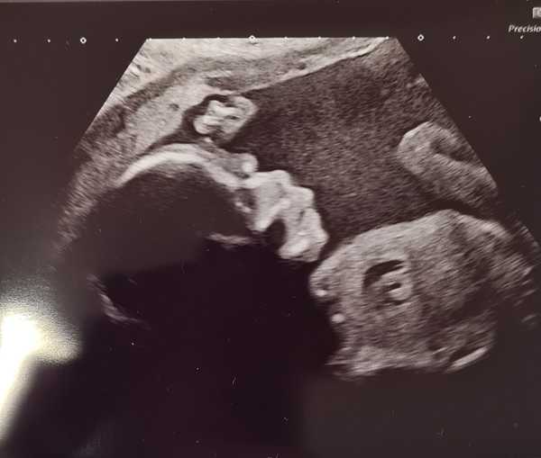 Due June 2022 (thread seven!)
