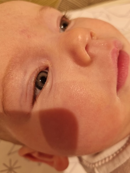 Line on baby's eyelid? With pic