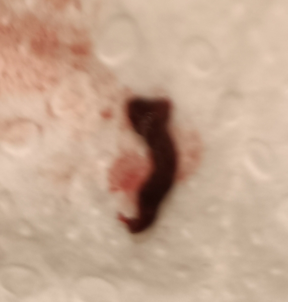 miscarriage?? **content warning - title edited by MNHQ**