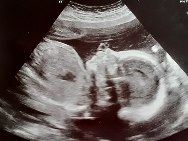 Due June 2022 (thread eight)
