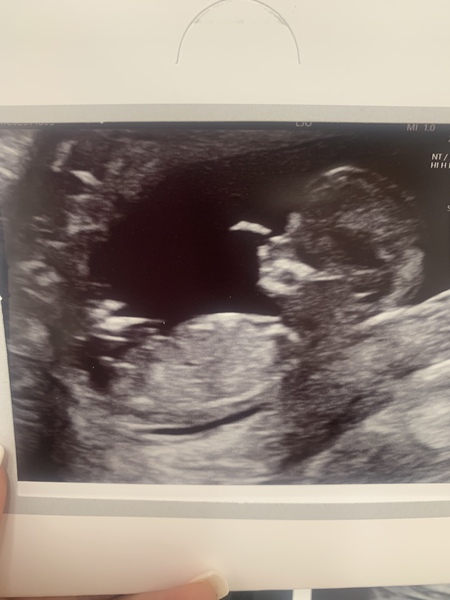 What are we thinking? Girl or Boy?
