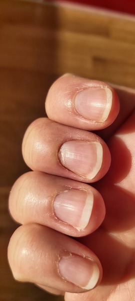 My hands are awfully rough! Help!