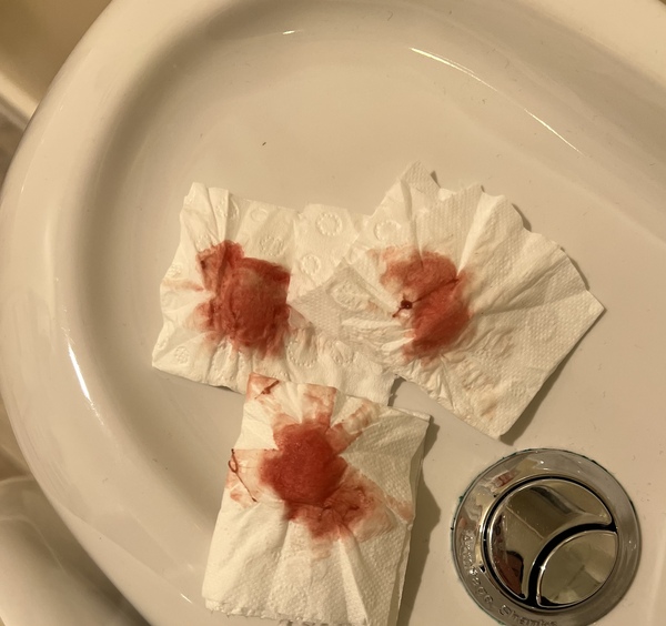 🌈Ttc after miscarriage thread 5 💕✨🤞🌈