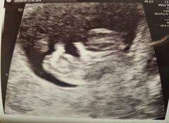 Due September 2022 (Thread 4)