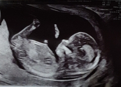 Girl or boy guesses