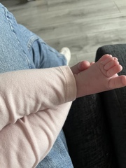 Can’t stop worrying about Cerbral Palsy
