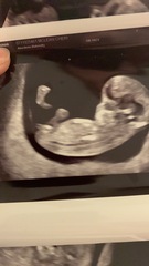 Boy or girl?