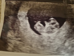 Due September 2022 - Thread #3