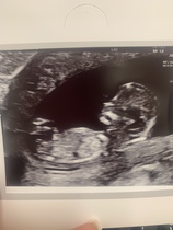What are we thinking? Girl or Boy?
