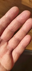 My hands are awfully rough! Help!