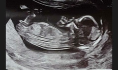 Girl or boy guesses