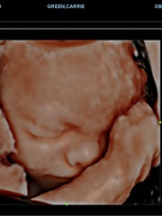 Due May 2022 (thread 4)