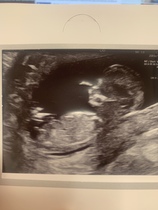 What are we thinking? Girl or Boy?