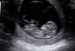 Due September 2022 - Thread #3