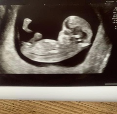 Boy or girl?
