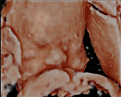 Due May 2022 (thread 4)