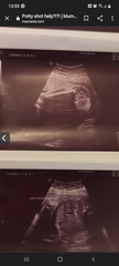 Boy or girl? 13 weeks