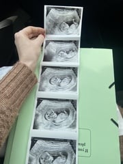Boy or girl? 13 weeks