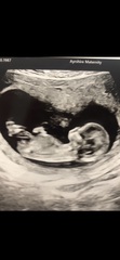 Nub theory 12w 2 days
