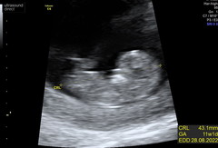 Due September 2022 - Thread #3