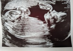 Due June 2022 (thread seven!)