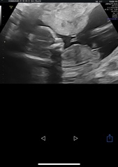 16 week scan- boy or girl??