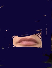 Lip fillers