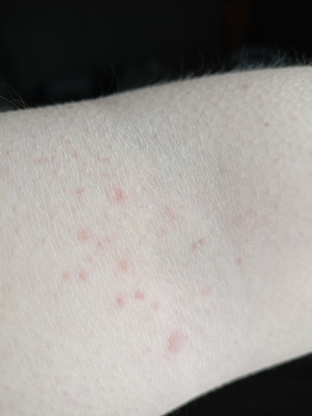 Help with skin condition