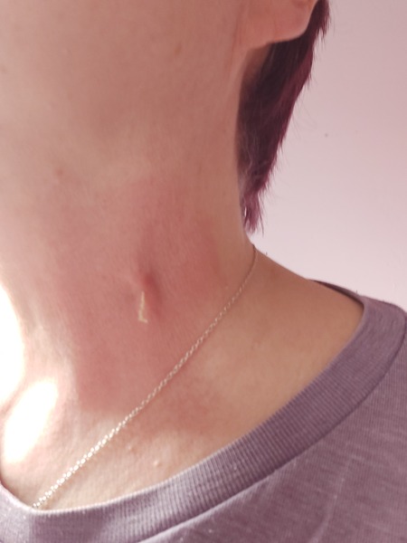 Is this about to blow?