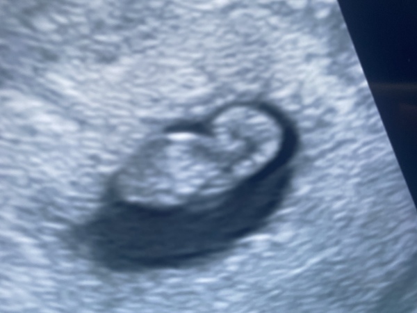 Due late Oct 🎃 - early Nov 🎉